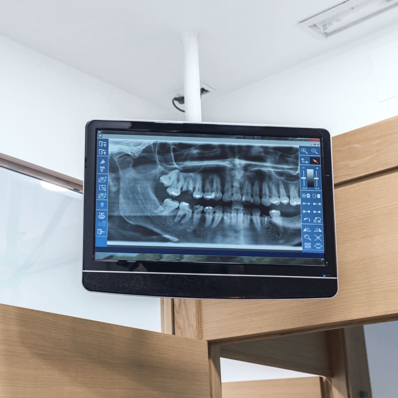 Dental Technology, Meteghan Dentist